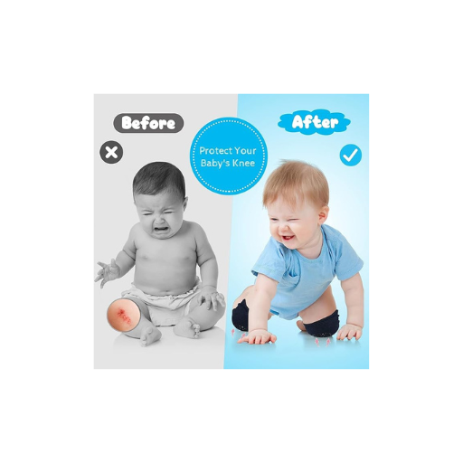 Baby Knee Pads for Crawling – Soft, Breathable & Adjustable Knee Protectors | Non-Slip, Washable Pads for Infants & Toddlers