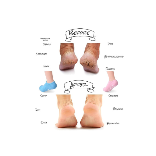 Gel Heel Socks & Moisturizing Foot Mask Set for Women – Cracked Heel Repair, Silicone Foot Protectors & Spa Socks for Soft, Hydrated Feet