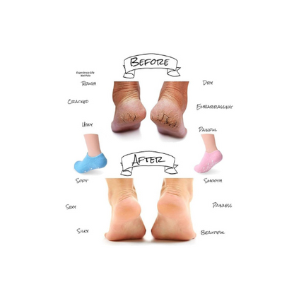 Gel Heel Socks & Moisturizing Foot Mask Set for Women – Cracked Heel Repair, Silicone Foot Protectors & Spa Socks for Soft, Hydrated Feet
